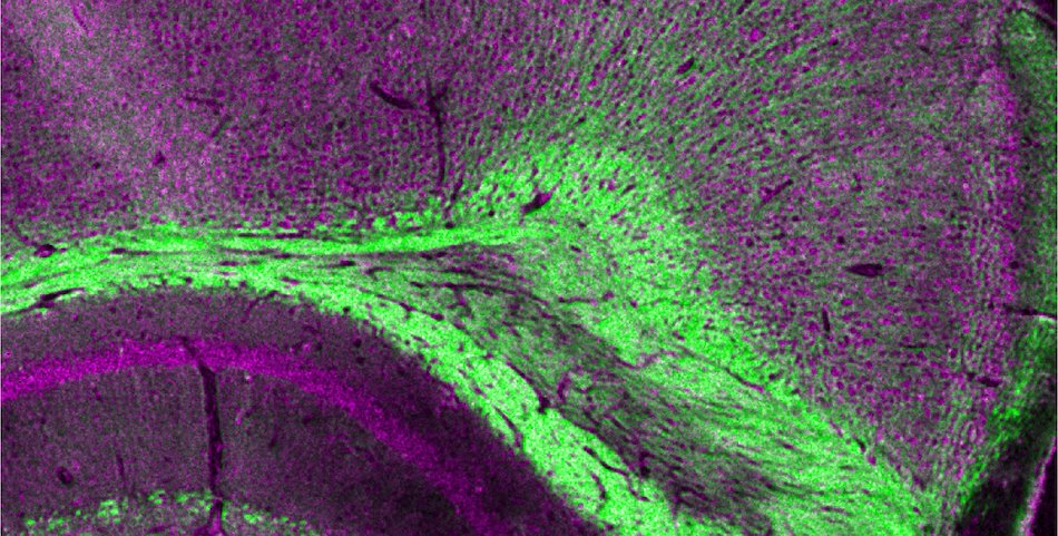 Mouse brain slices: UV and IR in combination