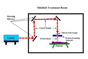 Laser proton therapy