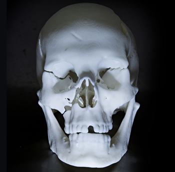 The laser generated skull revealed significant injuries Richard III sustained in battle.