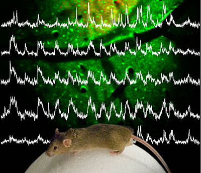 Neural activity recorded from neurons in the brain of an awake mouse.  