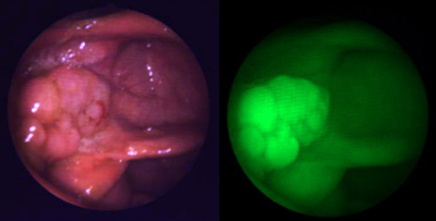 EM Imaging’s optical agents visualize pathology in vivo.