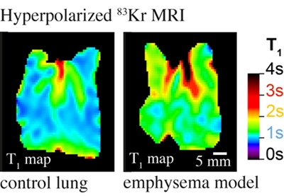 Hyperpolarization shows emphysema in rat model