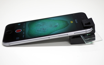 iPhone with clip-on microscope
