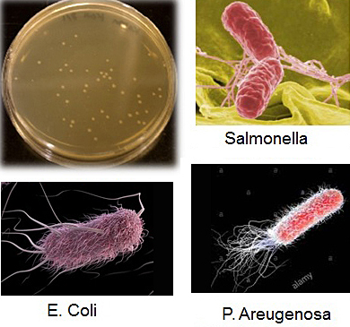 Small but deadly: examples of the bacteria Waterspy will detect. 