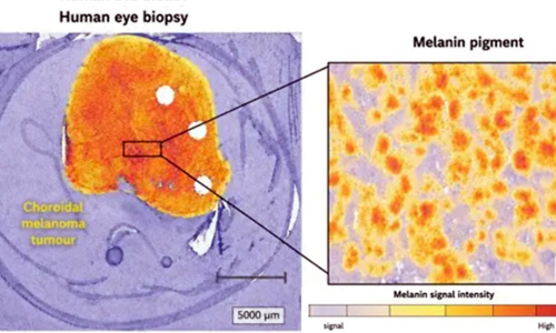 ICFO researchers refine Raman spectroscopy to better characterize melanin