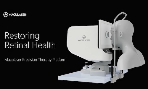 Maculaser lands funding from Zeiss, M2care for retinal therapy
