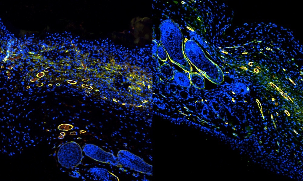Duke University uses OCT and AI for new glimpse into wound healing