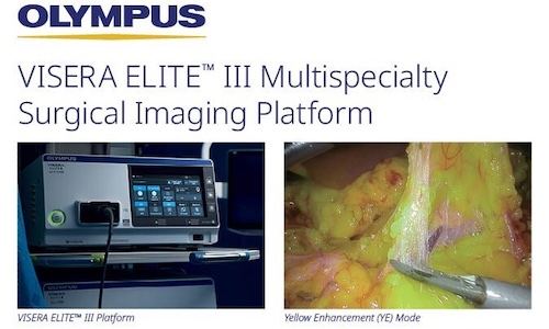 Olympus launches Visera Elite III platform in US for surgical imaging