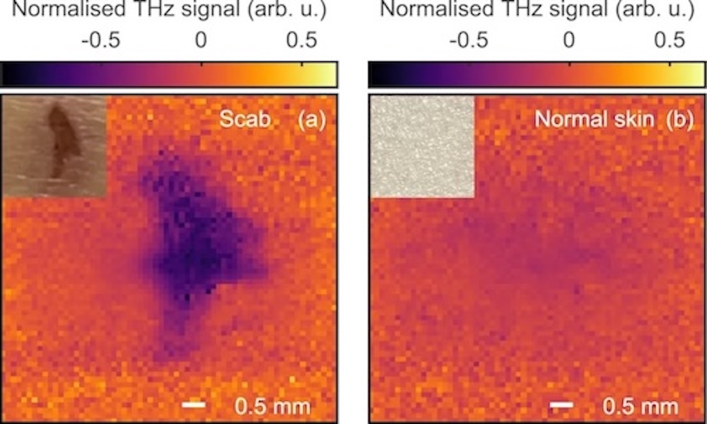 University of Warwick applies terahertz imaging to real-time diagnostics