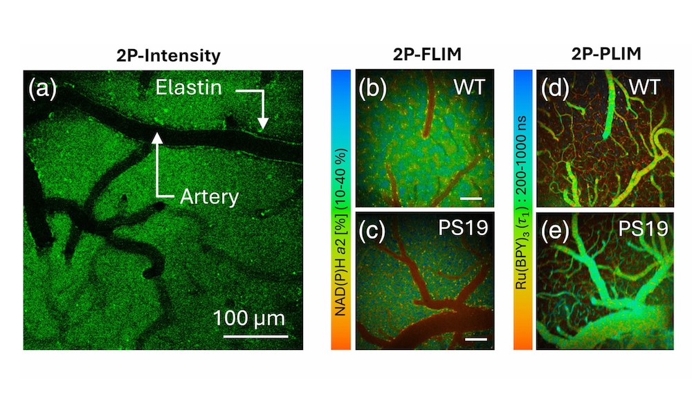 Combining fluorescence and phosphorescence shows new details of Alzheimer's