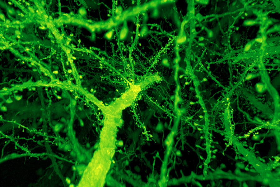 A forest of dendritic spines protrudes from the branches of neurons in the mouse cortex. Credit: Ruixuan Gao/Science.