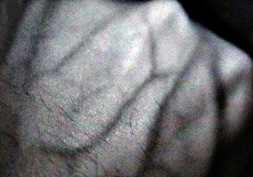 You're so vein: illumination with a SERIS NIR perovskite light-emitting diode on the back of a fist. This application allows for the imaging of subcutaneous blood vessels. Credit: Nature Photonics.