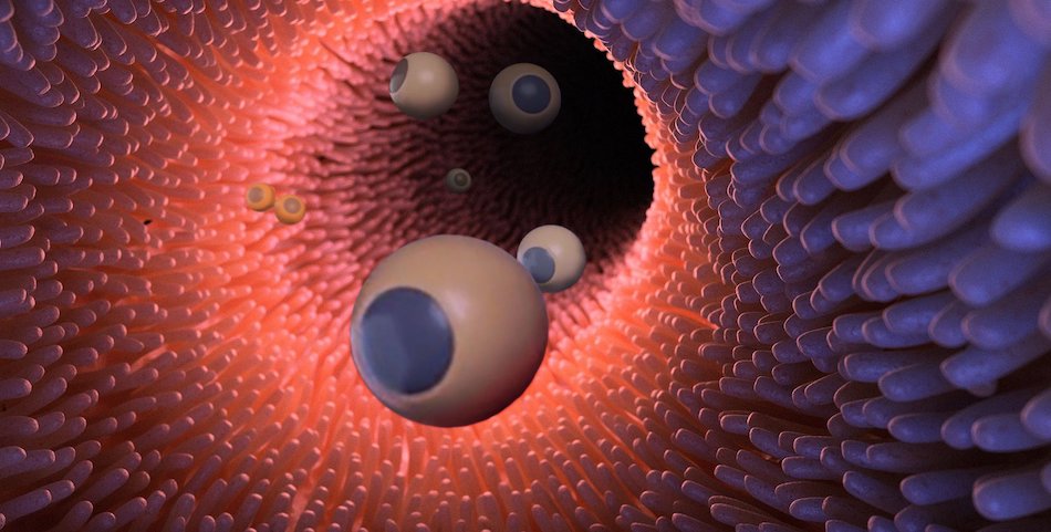 Artist's impression of the microspheres, monitored by photoacoustic tomography and activated by near-IR. Credit: Caltech.
