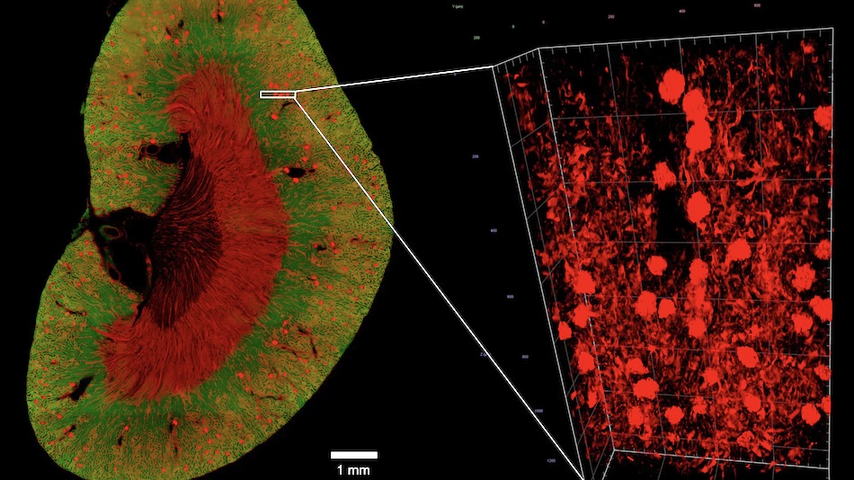 3D whole organ imaging and computational image analysis help to gain a better understanding of the mechanisms of various kidney diseases. Credit: Zeiss/U. Roostalu, Denmark.