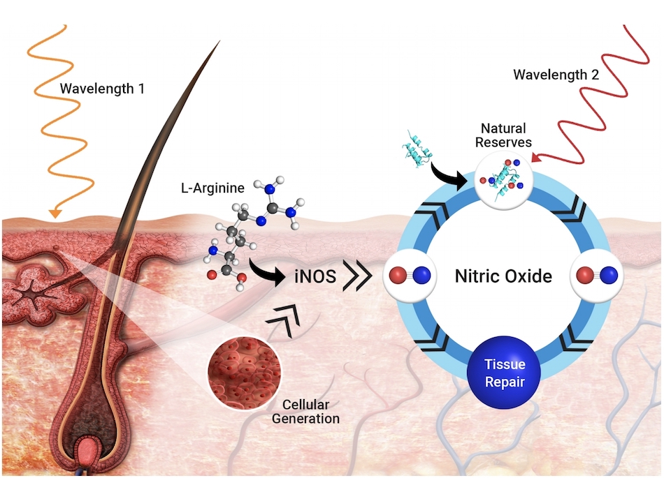 The influence of nitric oxide on tissue repair offers a way to promote the process. Credit: Revian/Business Wire.