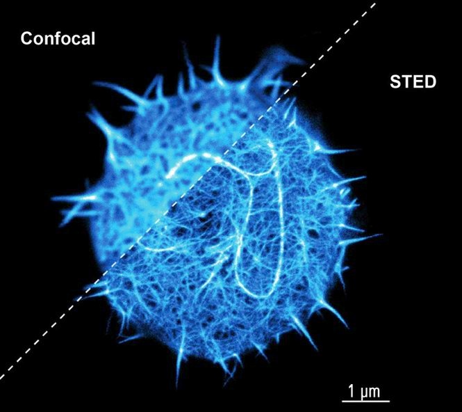 Gated STED substantially extends the functionality of the proven STED CW, giving the viewer the option of higher resolution or lower laser power. More images are obtained and smaller details revealed.

This image shows: Living T cell in suspension. 3D reconstruction of confocal and STED stacks. Maximum projection. Courtesy of Marco Fritsche, Mathias Clausen and Christian Eggeling, MRC Human Immunology Unit, Weatherall Institute of Molecular Medicine, University of Oxford, UK.