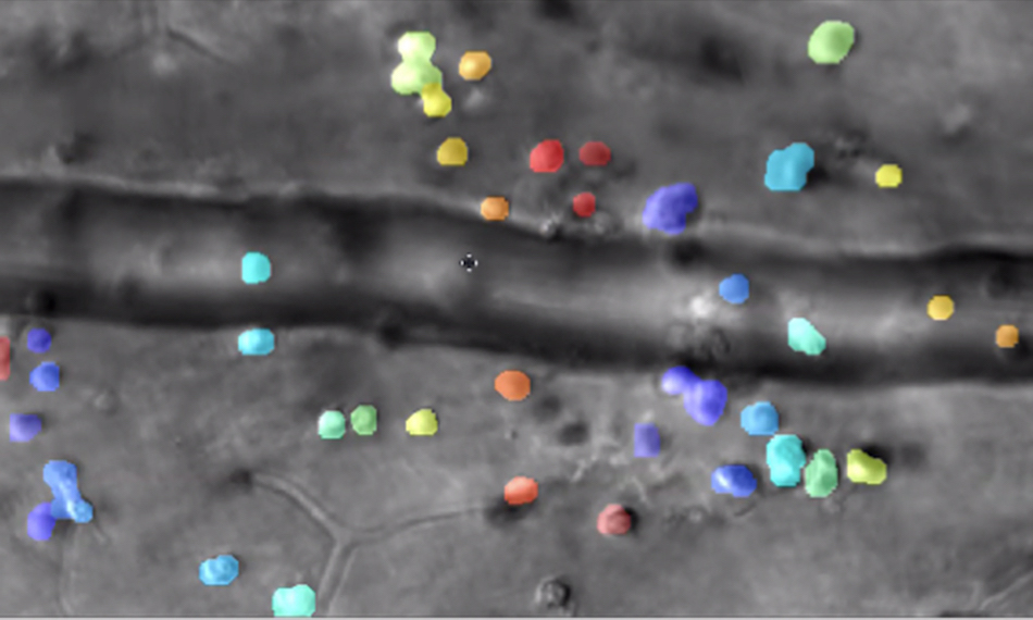 Microscopic immune cells seen escaping a nearby blood vessel in response to inflammation. The color overlay shows computer detection of single cells that are tracked over time. Credit: Schallek Lab/University of Rochester.
