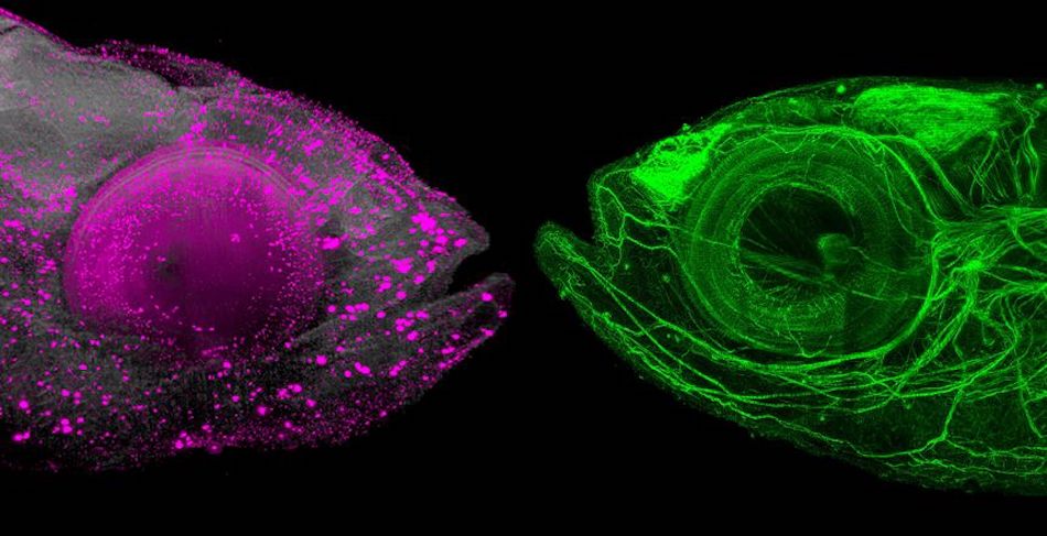 Light-sheet images of DEEP-Clear processed zebrafish showing proliferative cells (pink) and the nervous system (green). Credit: TU Wien/Max Perutz Labs.