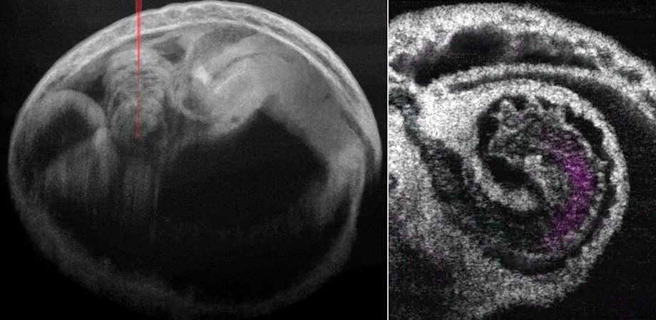 Mouse embryo, and heart with blood flow. Credit: Stevens Institute of Technology/Baylor College of Medicine/JBO.  