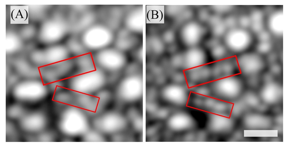 The simultaneously acquired OCT and SLO images. Rods are not as well resolved in the OCT projection (A) but can be identified in the SLO image (B). Scale bar is 10 micrometers.
Credit: Mehdi Azimipour/UC Davis Eye Center.