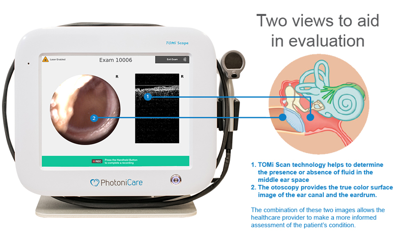 This year, the FDA granted clearance for Photonicare's TOMi Scope for non-invasive optical imaging of the middle ear. Image: Photonicare.