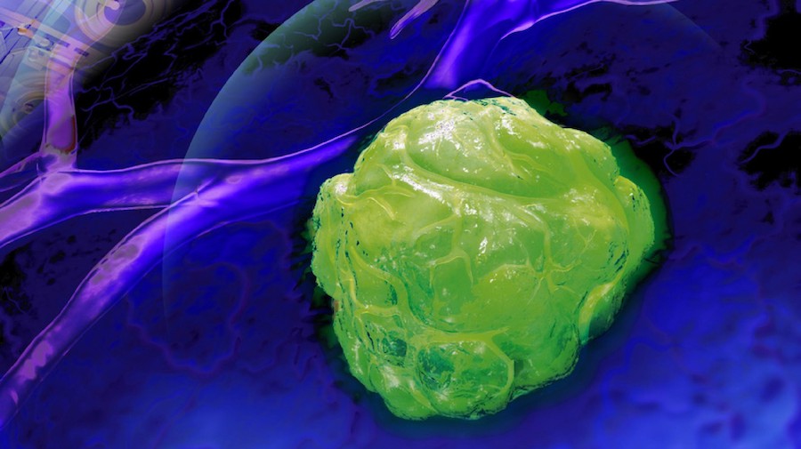 The new technique could assist clinicians to image the precise size and position of malignancies. Credit: EPFL.