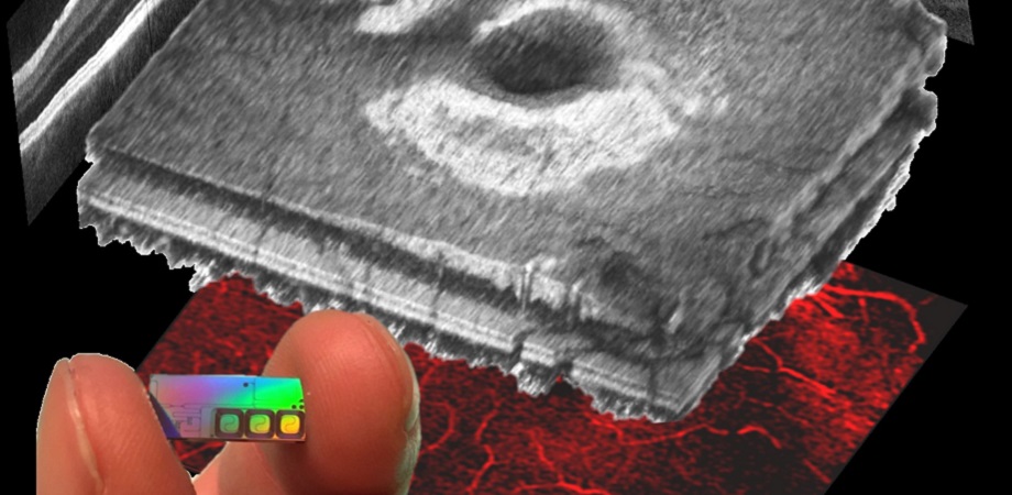 Ophthalmic OCT-on-a-chip is an example of the technique's current capabilities. Credit: OCTChip/JBO/SPIE. 