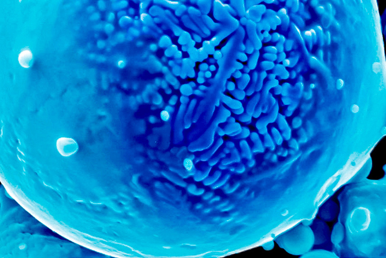 Colorized electron micrograph of a nickel powder alloy used in the Texas A&M study. Credit: Raiyan Seede.