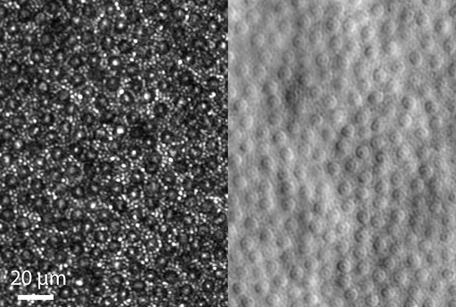 The mosaic of cone and rod photoreceptor cells is shown by confocal imaging (left) and split detection. Credit: Johnny Tam/National Eye Institute