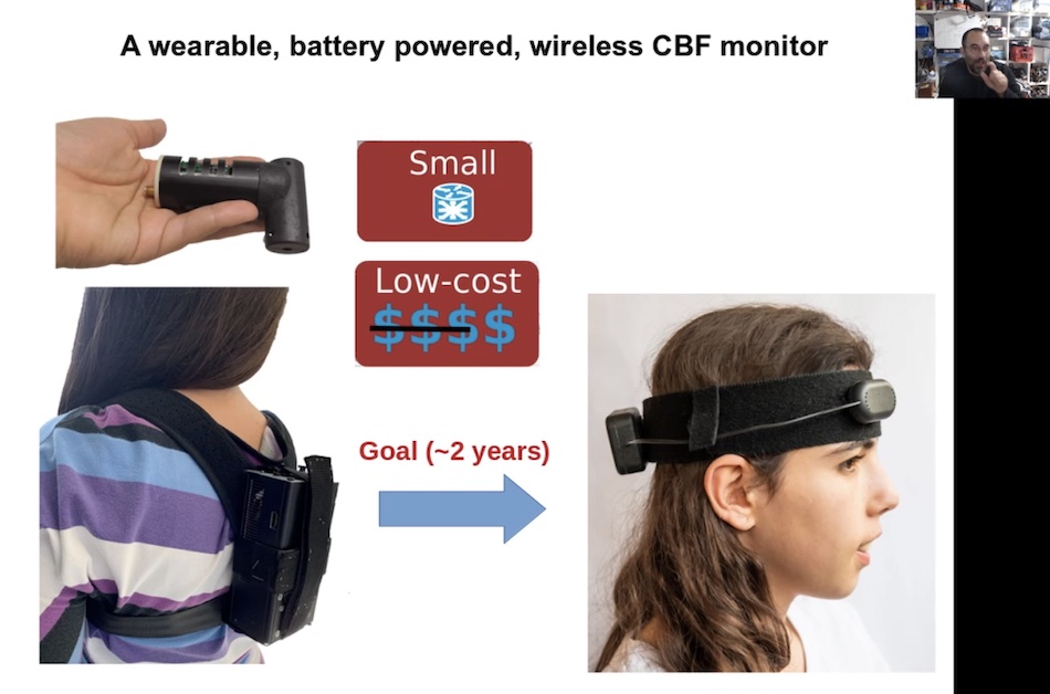 A wearable sensor could allow real-time monitoring of critical blood-flow parameters. Credit: Turgut Durduran/SPIE.