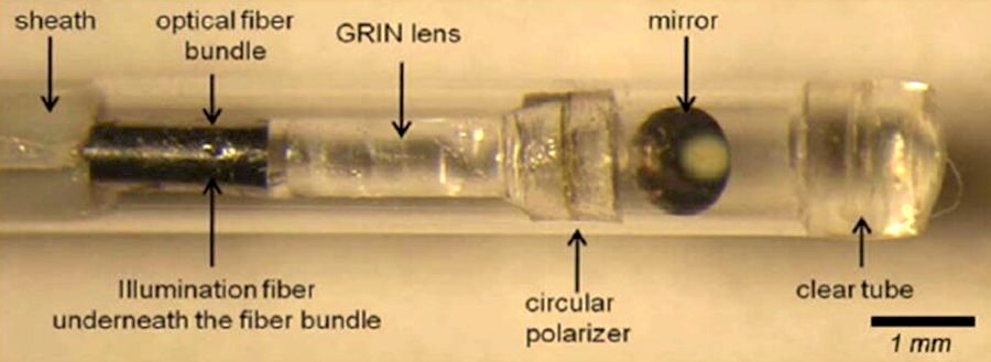 ILSI could detect coronary plaques that are likely to lead to a heart attack, using a small diameter intravascular catheter. Credit: Seemantini Nadkarni/Wellman Center for Photomedicine.