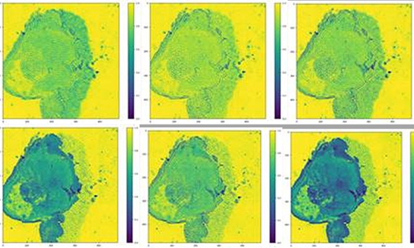Six images at relevant wavelengths to differentiate tumor cells. Credit: CEA-Leti.