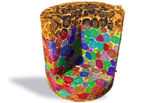 Aluminum copper alloy imaged and analyzed with the Xradia CrystalCT. This montage shows the multimodal nature of information CrystalCT delivers. Aluminum copper alloy imaged in absorption and diffraction contrast tomography. Colors indicate grain orientation overlaid onto absorption data that discern the copper along grain boundaries. Image: &copy; Zeiss.