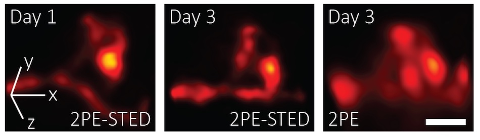 The Yale platform showed subtle changes that occurred over a period of time, changes hard to distinguish using two-photon microscopy alone. Credit: Joerg Bewersdorf/Yale School of Medicine.
