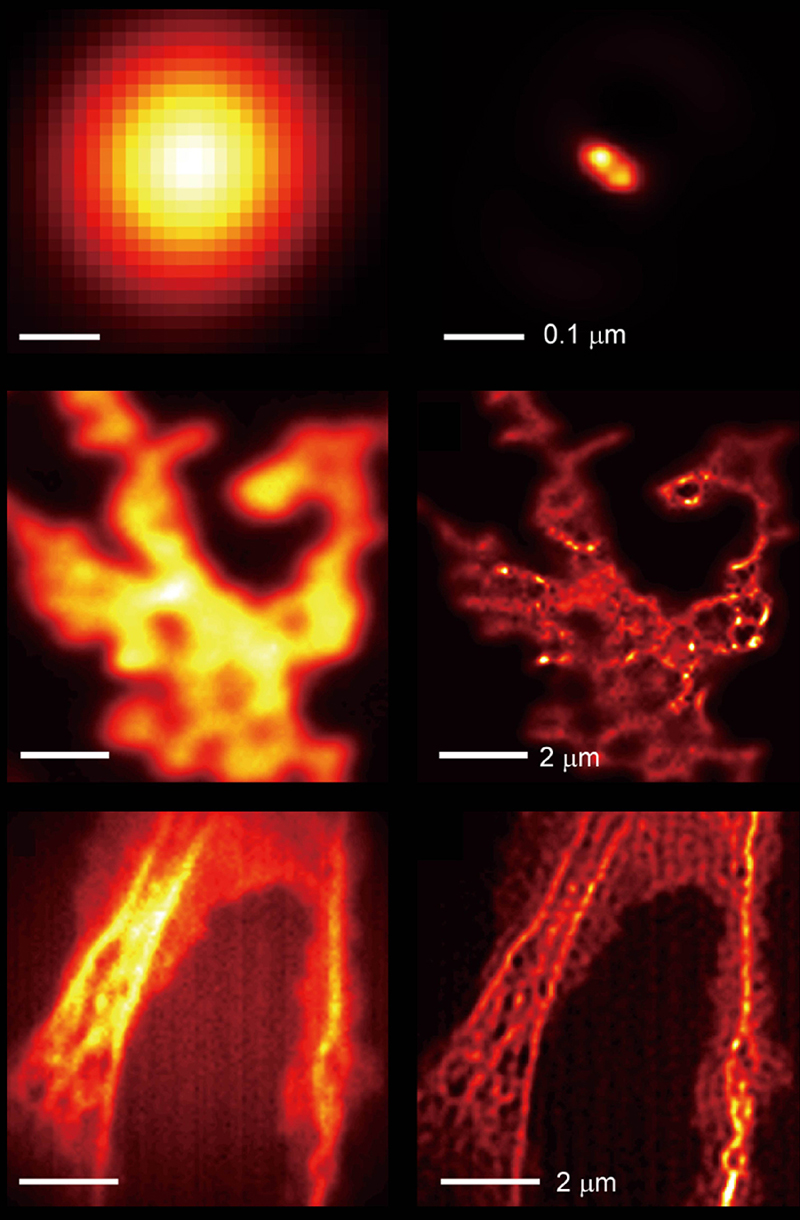 Comparison of images taken by a light microscope without the hyperbolic metamaterial (left column) and with the hyperbolic metamaterial (right column): two close fluorescent beads (top row), quantum dots (middle row), and actin filaments in Cos-7 cells (bottom row). Adapted from Nature Communications.