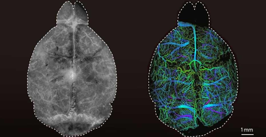 Left: Conventional fluorescence images of a mouse brain. Right: An image taken with the new diffuse optical localization imaging (DOLI) method. Credit: ETH Zurich/University of Zurich/Daniel Razansky.
