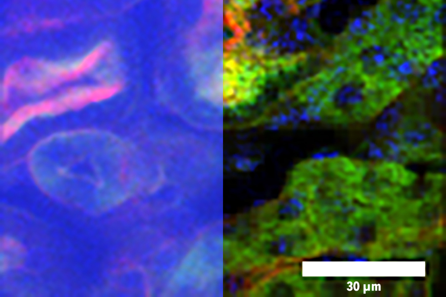 A temporal focusing microscopy (TFM) image (left) and DEEP image (right) of a kidney imaged through a scattering medium. Credit: MIT/Harvard.