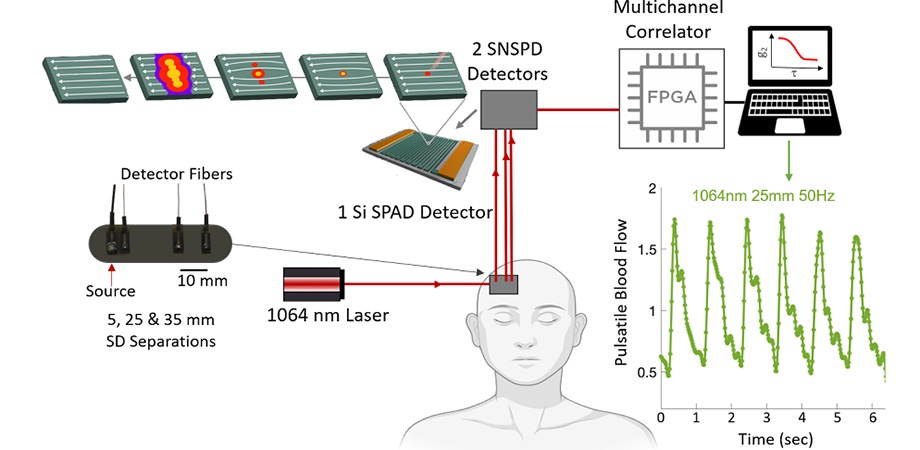 A superconducting nanowire single photon detector (SNSPD) brings better sensitivity to DCS measurements. Credit: SPIE/Ozana et al.