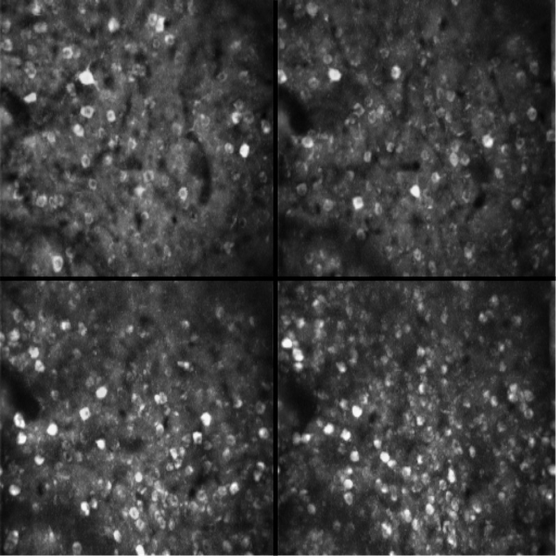 The new lightweight imaging device can capture several thousand cells in freely-moving animals and stitch multiple images together. Credit: Edvard Moser/KISN.