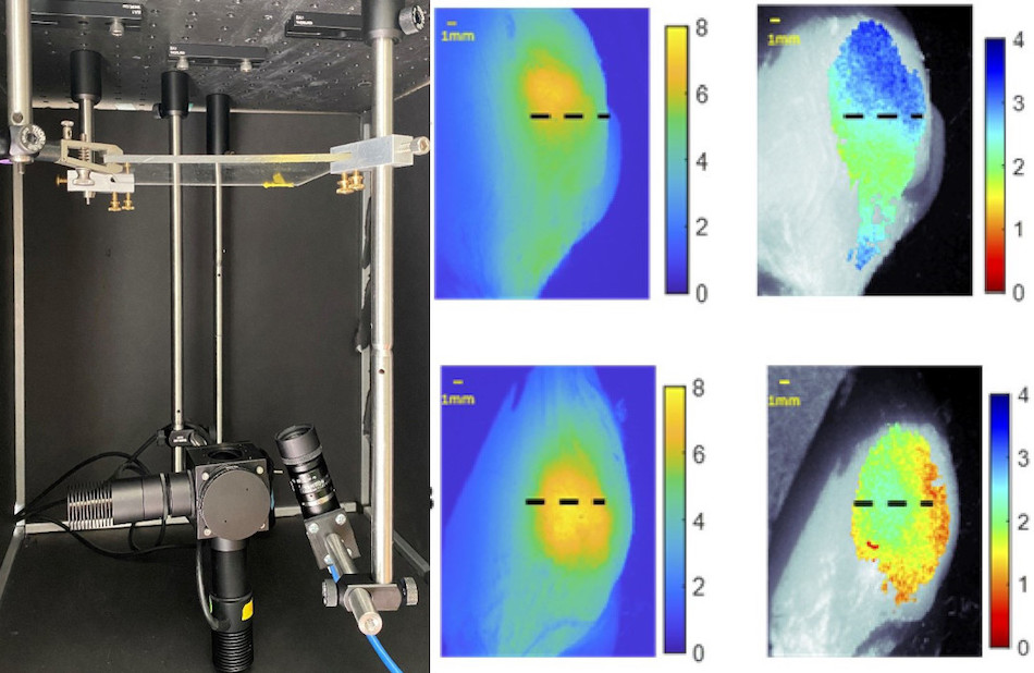 A low-cost imaging system that uses LEDs and a CMOS camera can determine the depth of tumor cells in the body. Credit: Christine M. O'Brien, Washington University in St. Louis.