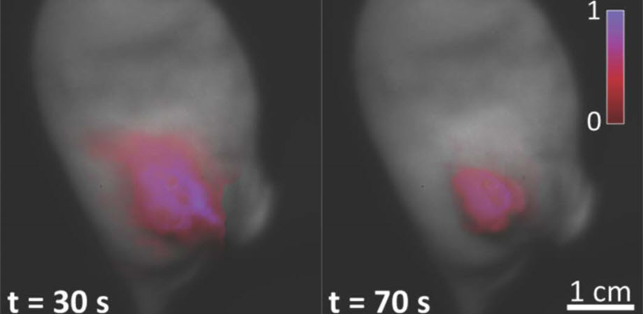 The signal obtained from cancerous cells was over five times stronger than that from surrounding healthy oxygenated tissues. Cancerous tissue reoxygenates slower than healthy tissue, so palpation prior to imaging amplified the contrast. After 70 seconds, tumor tissue hypoxia on the right is most clearly visible via delayed fluorescence imaging. Credit: Arthur Petusseau/JBO.