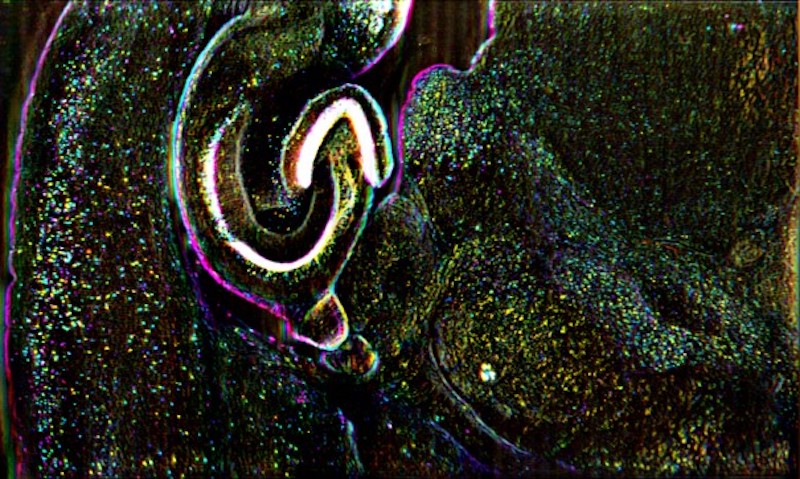 Meso-OPM imaging of fluorescently labeled mouse brain slices in which the cells were kept alive. Credit: Ji Yi, Johns Hopkins University.