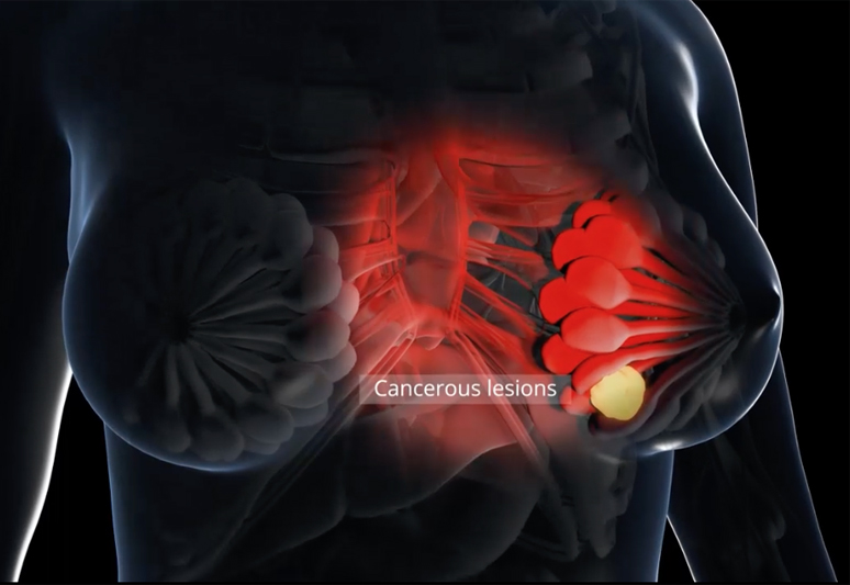 With the ability to visualize and quantify sub-organ structures at several centimeters of depth, OAI provides new insights into a variety of diseases. Image courtesy of iThera Medical.