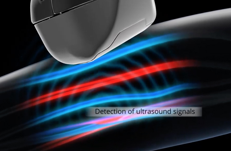 Due to its spatiotemporal resolution, penetration depth, sensitivity and specificity, optoacoustic imaging (OAI) can be used for a multitude of applications, for both clinical and preclinical research. Image courtesy of iThera Medical.