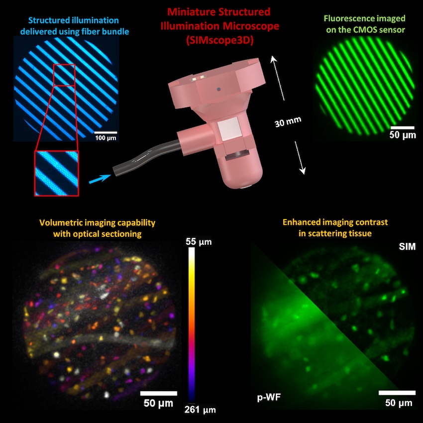 Researchers developed a head-mounted microscope that uses structured illumination to remove out-of-focus light with optical sectioning. This enables deep imaging while also enhancing image contrast in scattering tissue. Credit: Omkar D. Supekar/Emily Gibson, University of Colorado.