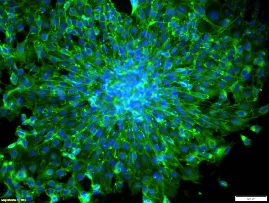 Actin-stained fibroblast spheroid for Lift transfer cultured in laser fabricated micro wells. Credit: Fraunhofer ILT.