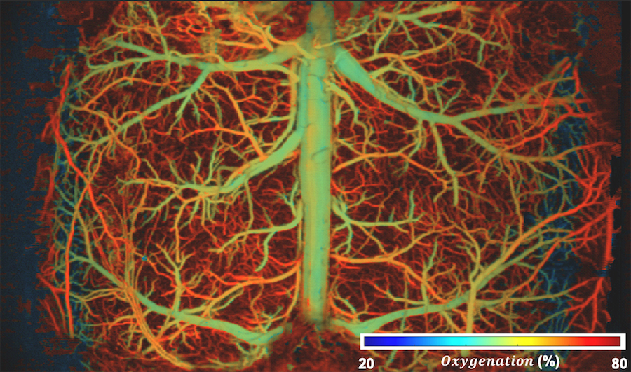 The vasculature of the brain, with the colors illuminating how capillaries experience varying levels of oxygenation as the brain undergoes hypoxia. Credit: Duke University.