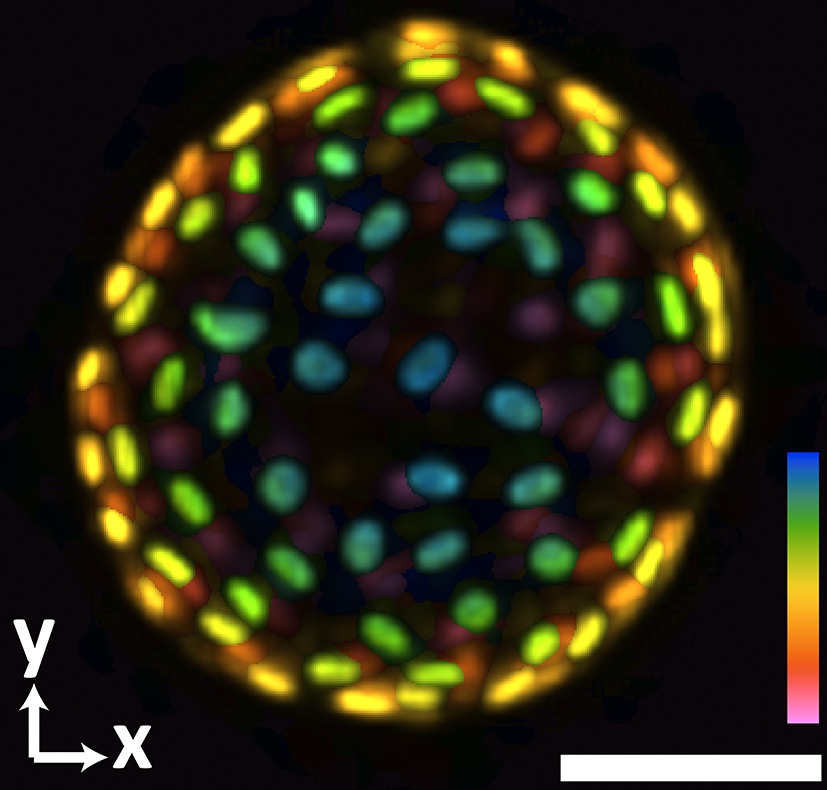 A colon organoid imaged by the new system. The raw image was captured in 0.1 seconds. The coloration represents depths of 60 and -60 micrometers from the focal plan to depict the organoid in three dimensions. Credit: Shu Jia, Wenhao Liu.