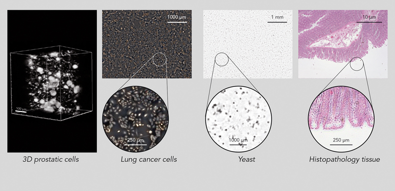 Observation at different scales of the main morphological characteristics of cellular tissues (> 100 &mu;m), cells (> 5 &mu;m) and detection of bacteria (1 &mu;m). Credit: CEA LETI.