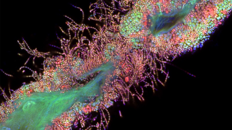 Bacteria bound to epithelial cells of the human tongue, acquired with the Zeiss LSM 900 with Airyscan. Credit: T. deCarvalho, University of Maryland.